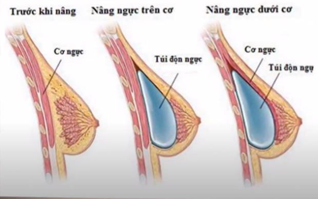 nhung-luu-y-truoc-khi-thuc-hien-phau-thua-tham-my-dkgh-1