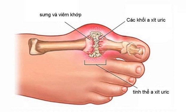 dep-khong-gioi-han-t88-vanhoadoanhnhan-3